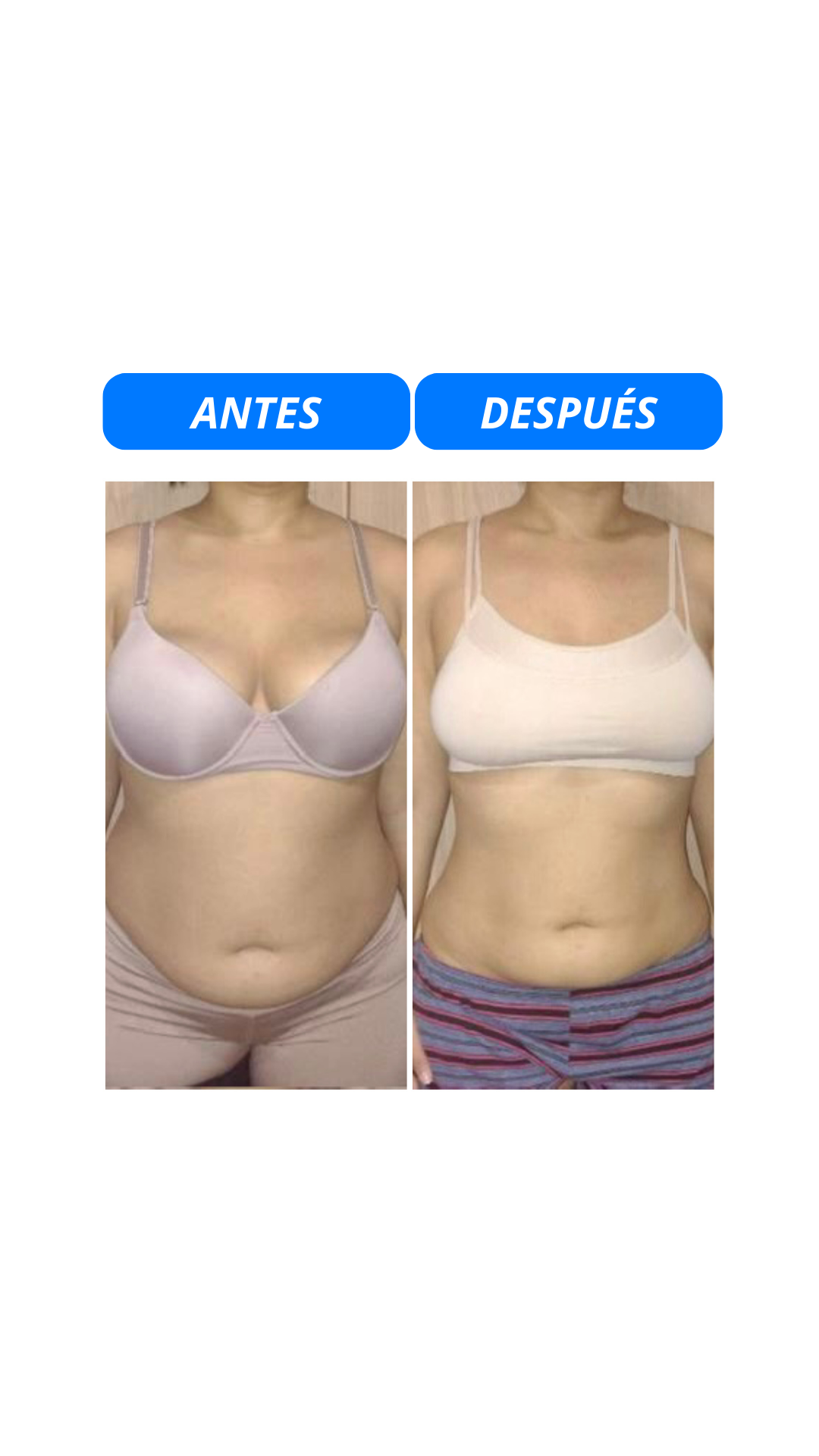 Comparativa antes y después
